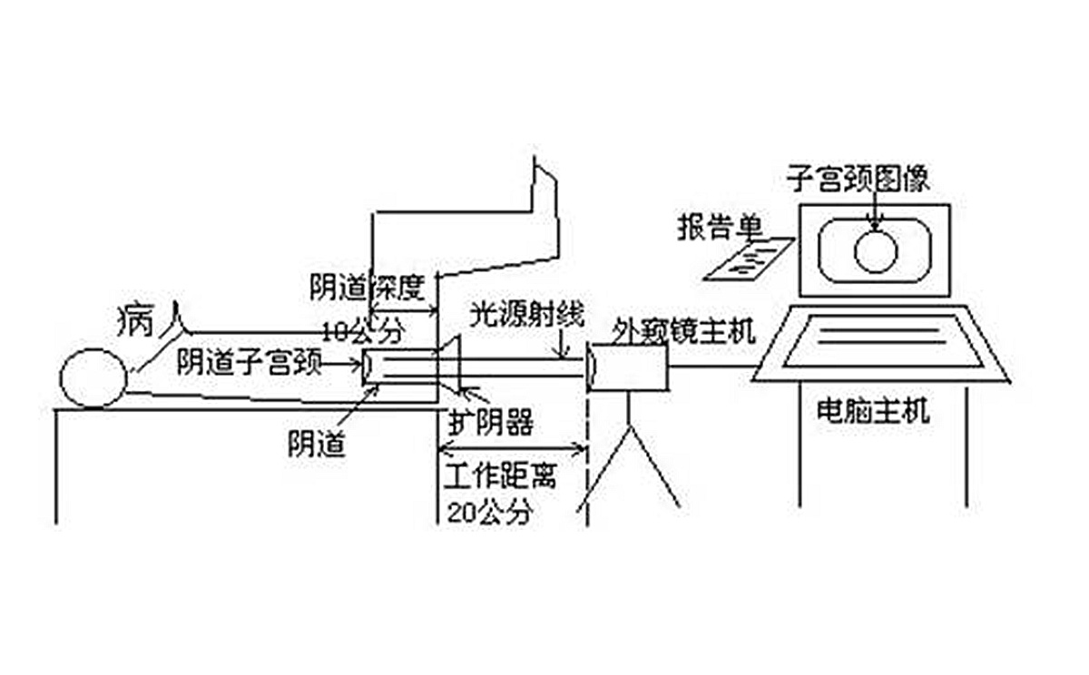 如何使用數(shù)碼電子陰道鏡?