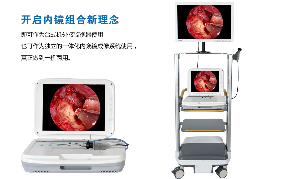 用戶反饋：YKD-9003內(nèi)窺鏡攝像機(jī)獲得好評